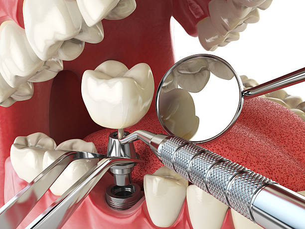 Best Emergency Treatment for Toothache in Maine, WI